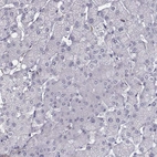 Immunohistochemical staining of human liver shows negative cytoplasmic positivity in hepatocytes as expected.