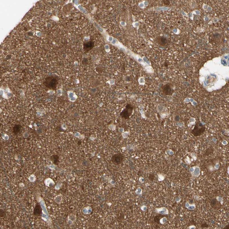 Anti-PPP3CB Antibody