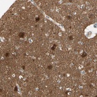 Anti-PPP3CB Antibody