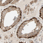 Anti-OXSR1 Antibody