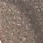 Immunohistochemical staining of human tonsil shows moderate cytoplasmic positivity in germinal center cells.