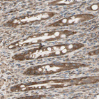 Anti-OXSR1 Antibody