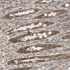 Immunohistochemical staining of human rectum shows moderate cytoplasmic positivity in glandular cells.
