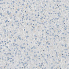 Immunohistochemical staining of human liver shows no positivity in hepatocytes as expected.