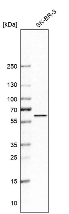 Western blot analysis in human cell line SK-BR-3.