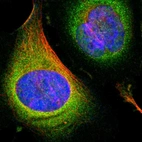 Immunofluorescent staining of human cell line U-2 OS shows localization to cytosol.
