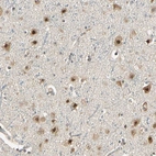 Immunohistochemical staining of human cerebral cortex shows moderate to strong nuclear positivity in neurons.