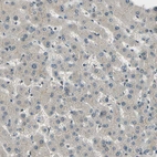 Immunohistochemical staining of human liver shows no nuclear positivity in hepatocytes as expected.
