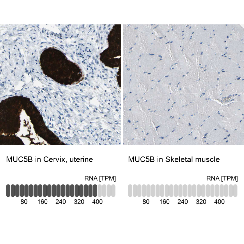 Anti-MUC5B Antibody