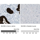 Anti-MUC5B Antibody