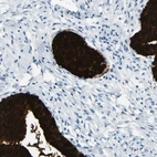 Immunohistochemical staining of human cervix, uterine shows very strong extracellular space positivity in glandular cells.