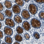 Immunohistochemical staining of human lower gastrointestinal shows strong extracellular space positivity in glandular cells.