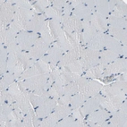Immunohistochemical staining of human skeletal muscle shows no positivity in myocytes as expected.