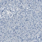 Immunohistochemical staining of human pancreas shows no positivity in exocrine glandular cells as expected.