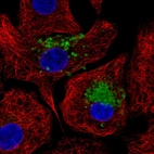 Immunofluorescent staining of human cell line A549 shows localization to vesicles.