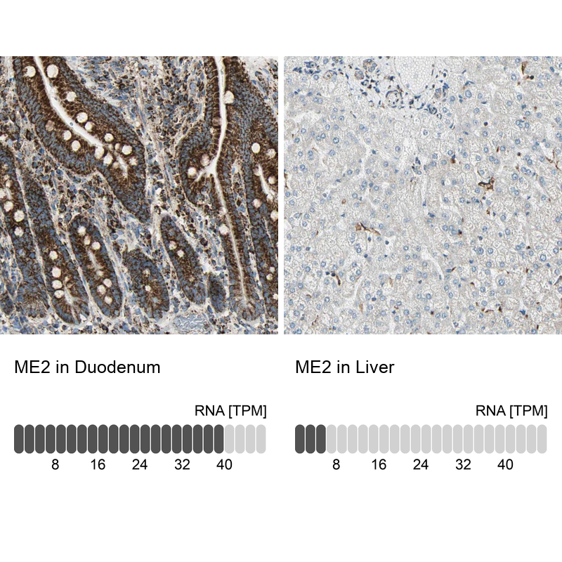 Anti-ME2 Antibody