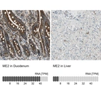 Anti-ME2 Antibody