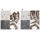 Immunohistochemical staining of human cerebral cortex, colon, lymph node and testis using Anti-ME2 antibody HPA008247 (A) shows similar protein distribution across tissues to independent antibody HPA008880 (B).