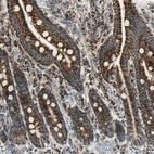 Immunohistochemical staining of human duodenum shows high expression.