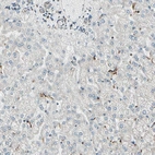 Immunohistochemical staining of human liver shows low expression as expected.