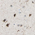 Immunohistochemical staining of human cerebral cortex using Anti-ME2 antibody HPA008247.
