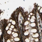 Immunohistochemical staining of human colon using Anti-ME2 antibody HPA008247.