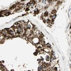 Immunohistochemical staining of human testis using Anti-ME2 antibody HPA008247.