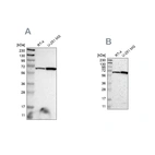 Western blot analysis using Anti-ME2 antibody HPA008247 (A) shows similar pattern to independent antibody HPA008880 (B).