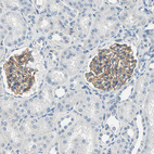 Immunohistochemical staining of human kidney shows strong membranous positivity in cells in glomeruli.