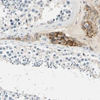 Immunohistochemical staining of human testis shows strong membranous positivity in Leydig cells.