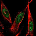 Immunofluorescent staining of human cell line U-251 MG shows localization to nucleoplasm.