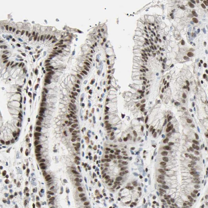 Anti-C1orf174 Antibody