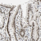 Anti-C1orf174 Antibody