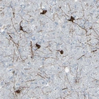 Immunohistochemical staining of human cerebral cortex shows moderate to strong cytoplasmic positivity in neuronal cells.