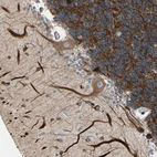 Immunohistochemical staining of human cerebellum shows strong cytoplasmic positivity..