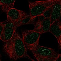 Anti-GTF3C2 Antibody