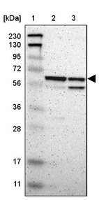 Lane 1: Marker [kDa] 230, 130, 95, 72, 56, 36, 28, 17, 11_br/_Lane 2: Human cell line RT-4_br/_Lane 3: Human cell line U-251MG sp