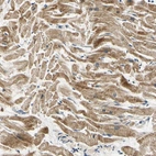Anti-PDK2 Antibody