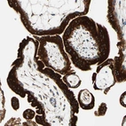 Immunohistochemical staining of human placenta shows strong granular cytoplasmic positivity in trophoblastic cells.