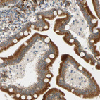 Immunohistochemical staining of human duodenum shows strong granular cytoplasmic positivity in glandular cells.