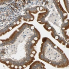 Immunohistochemical staining of human duodenum shows strong granular cytoplasmic positivity in glandular cells.