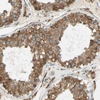 Immunohistochemical staining of human testis shows strong granular cytoplasmic positivity in cells in seminiferous ducts.