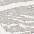 Immunohistochemical staining of human skeletal muscle shows no positivity in myocytes as expected.