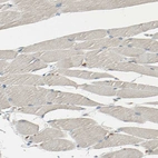 Immunohistochemical staining of human skeletal muscle shows no positivity in myocytes as expected.