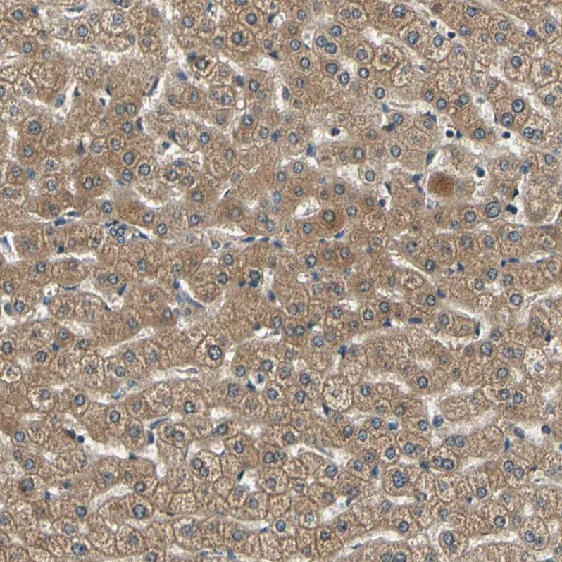Anti-LPGAT1 Antibody