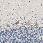 Immunohistochemical staining of human cerebellum shows moderate to strong cytoplasmic positivity in Purkinje cells.