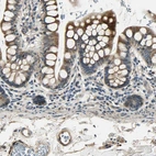 Immunohistochemical staining of human upper gastrointestinal tract shows moderate to strong cytoplasmic positivity in glandular cells.