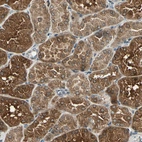 Immunohistochemical staining of human kidney shows moderate to strong cytoplasmic positivity in cells in tubules.