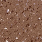 Anti-MCCC1 Antibody