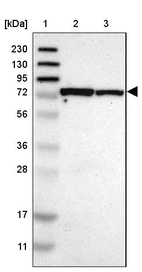 Lane 1: Marker [kDa] 230, 130, 95, 72, 56, 36, 28, 17, 11_br/_Lane 2: Human cell line RT-4_br/_Lane 3: Human cell line U-251MG sp